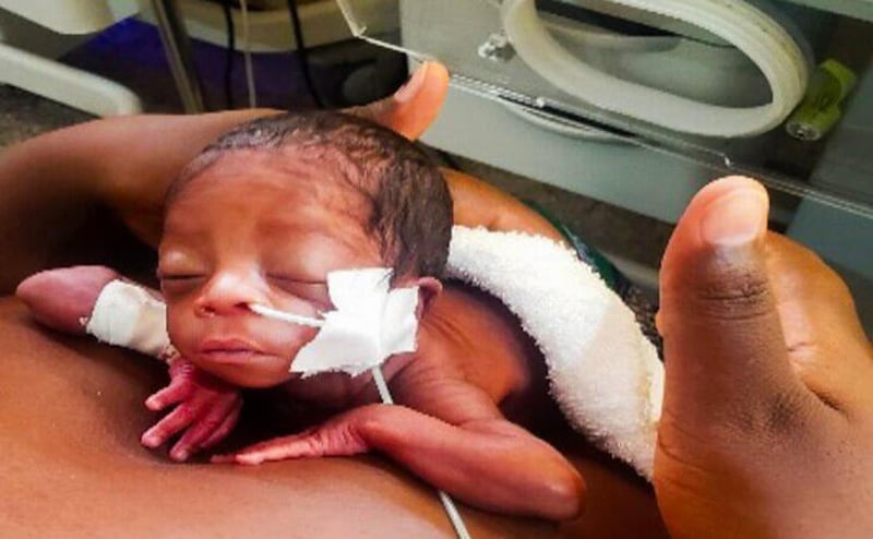 Un recién nacido descansa piel con piel sobre el pecho de su madre, pocos días después de nacer de forma prematura en el Hospital General Lewanika, en la provincia Occidental de Zambia, en diciembre de 2024.